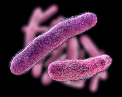 How to Recognize Symptoms of Shigella Infection