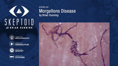 The Cause of Morgellons Disease - A Few Facts