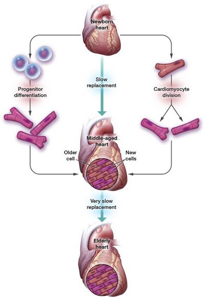 What is Stem Cell Cardiac Disease?
