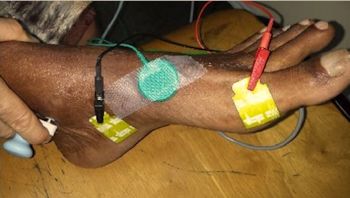 EMG Testing Can Assist in Diagnosing Many Medical Conditions