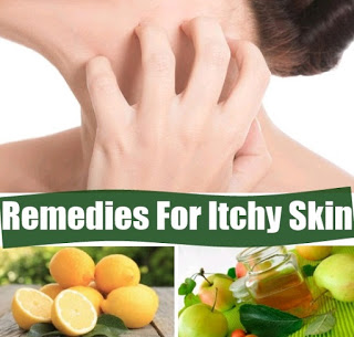 Simple Home Remedies for Eczema
